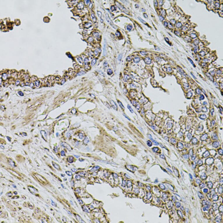 Immunohistochemistry - Anti-TMC1 Antibody (A17097) - Antibodies.com