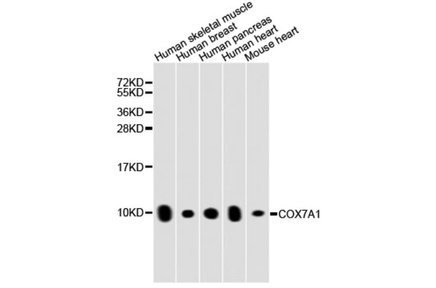 Western Blot - Anti-COX7A1 Antibody (A8707) - Antibodies.com