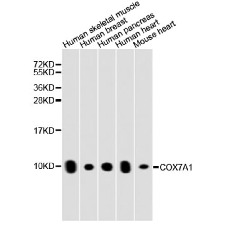 Western Blot - Anti-COX7A1 Antibody (A8707) - Antibodies.com