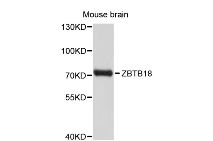 Western Blot - Anti-ZNF238 Antibody (A8850) - Antibodies.com