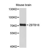 Western Blot - Anti-ZNF238 Antibody (A8850) - Antibodies.com