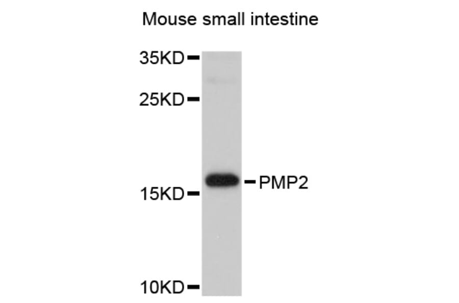 Western Blot - Anti-PMP2 Antibody (A8851) - Antibodies.com