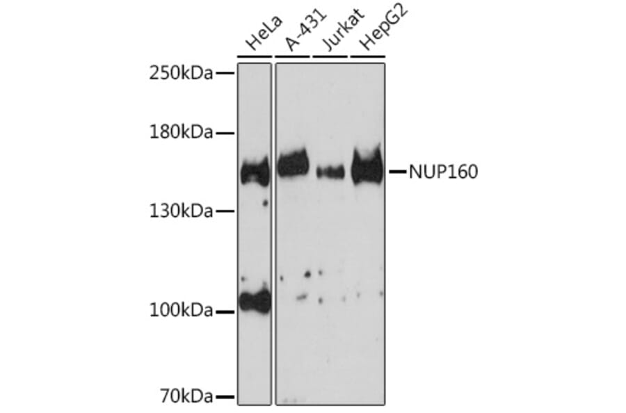 Western Blot - Anti-NUP160 Antibody (A17106) - Antibodies.com