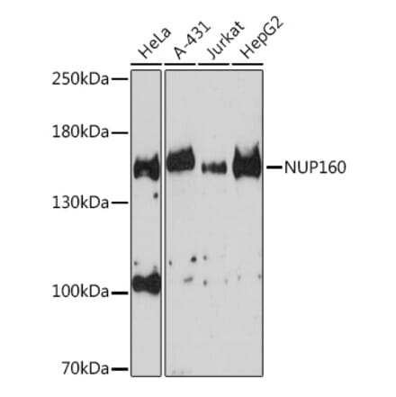 Western Blot - Anti-NUP160 Antibody (A17106) - Antibodies.com