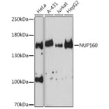 Western Blot - Anti-NUP160 Antibody (A17106) - Antibodies.com