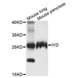 Western Blot - Anti-IYD Antibody (A9206) - Antibodies.com