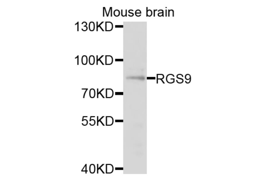 Western Blot - Anti-RGS9 Antibody (A9326) - Antibodies.com