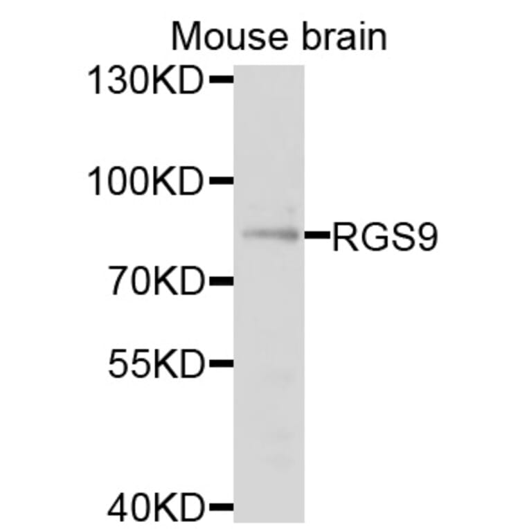 Western Blot - Anti-RGS9 Antibody (A9326) - Antibodies.com