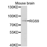 Western Blot - Anti-RGS9 Antibody (A9326) - Antibodies.com