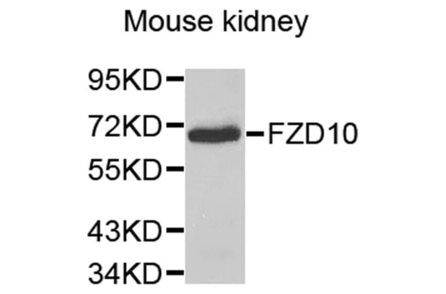 Western Blot - Anti-FZD10 Antibody (A9335) - Antibodies.com