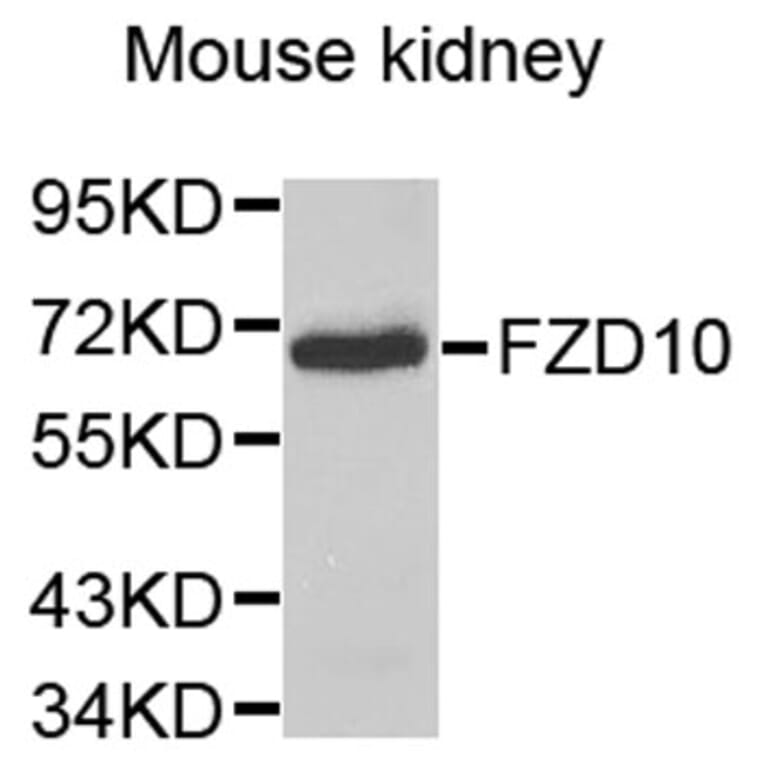 Western Blot - Anti-FZD10 Antibody (A9335) - Antibodies.com