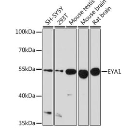 Western Blot - Anti-EYA1 Antibody (A17113) - Antibodies.com