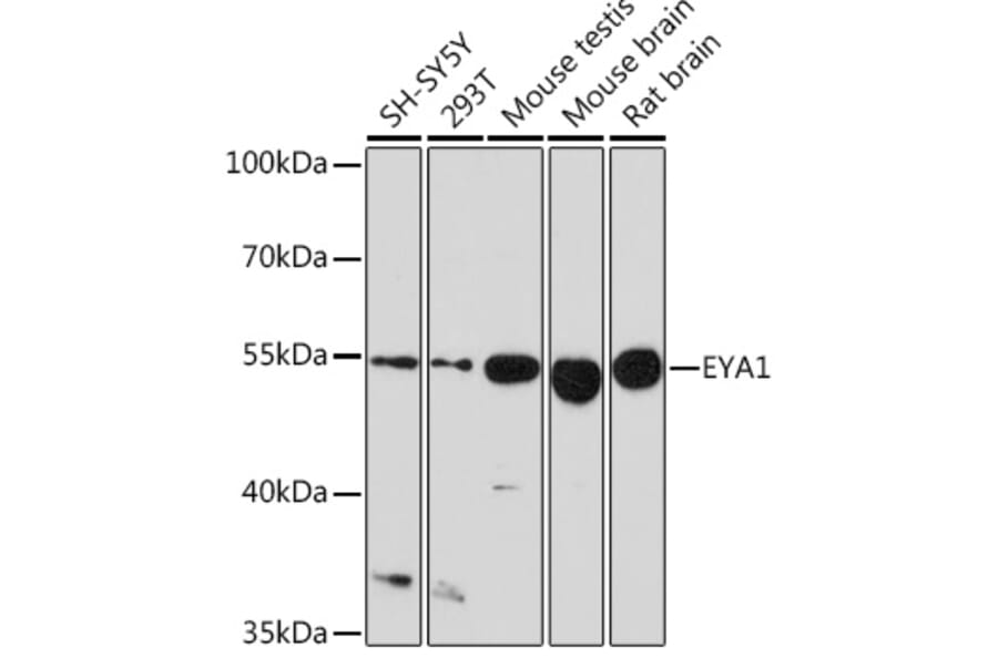 Western Blot - Anti-EYA1 Antibody (A17113) - Antibodies.com