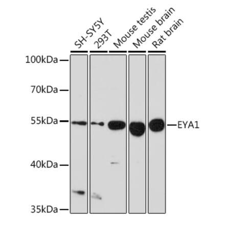 Western Blot - Anti-EYA1 Antibody (A17113) - Antibodies.com