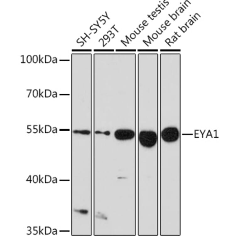 Western Blot - Anti-EYA1 Antibody (A17113) - Antibodies.com