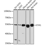 Western Blot - Anti-EYA1 Antibody (A17113) - Antibodies.com