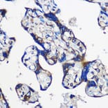 Immunohistochemistry - Anti-EYA1 Antibody (A17113) - Antibodies.com