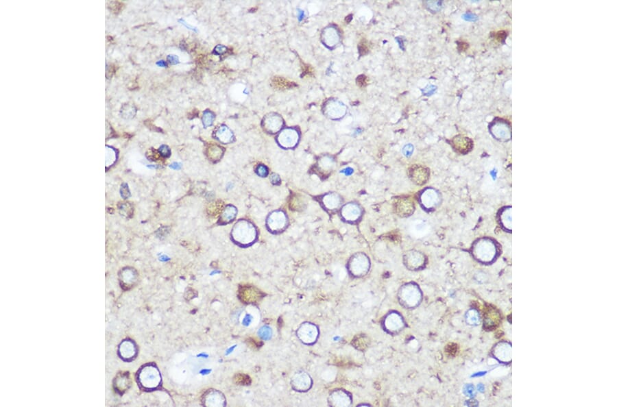 Immunohistochemistry - Anti-EYA1 Antibody (A17113) - Antibodies.com