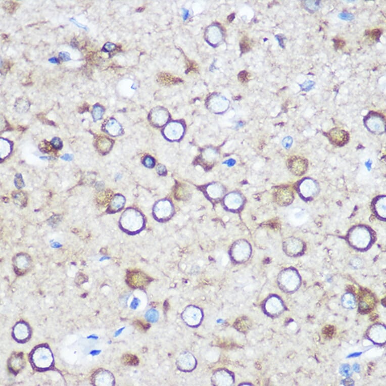 Immunohistochemistry - Anti-EYA1 Antibody (A17113) - Antibodies.com