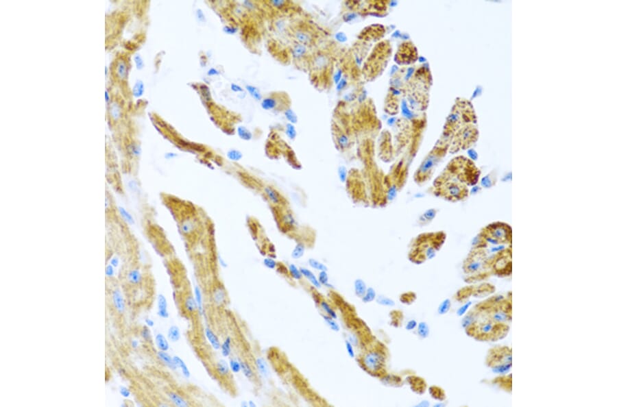 Immunohistochemistry - Anti-COL9A3 Antibody (A17118) - Antibodies.com