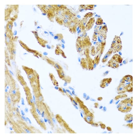 Immunohistochemistry - Anti-COL9A3 Antibody (A17118) - Antibodies.com