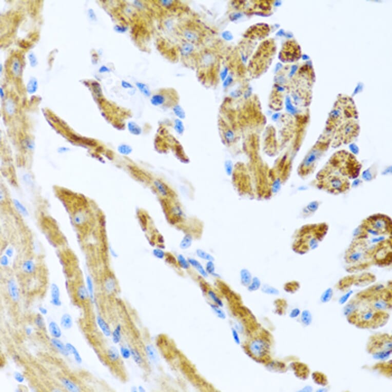 Immunohistochemistry - Anti-COL9A3 Antibody (A17118) - Antibodies.com