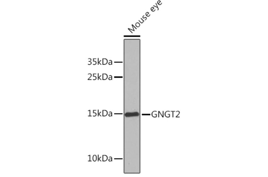 Western Blot - Anti-GNGT2 Antibody (A17119) - Antibodies.com