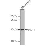 Western Blot - Anti-GNGT2 Antibody (A17119) - Antibodies.com