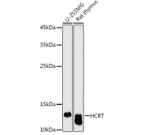 Western Blot - Anti-Orexin Antibody (A17120) - Antibodies.com