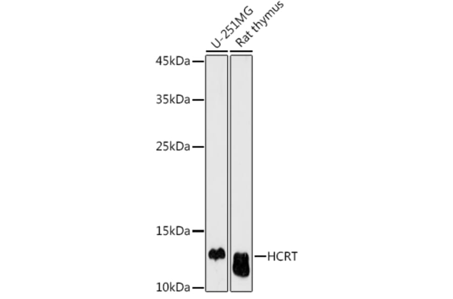 Western Blot - Anti-Orexin Antibody (A17120) - Antibodies.com