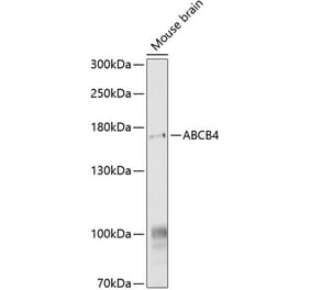 Western Blot - Anti-ABCB4 Antibody (A17122) - Antibodies.com
