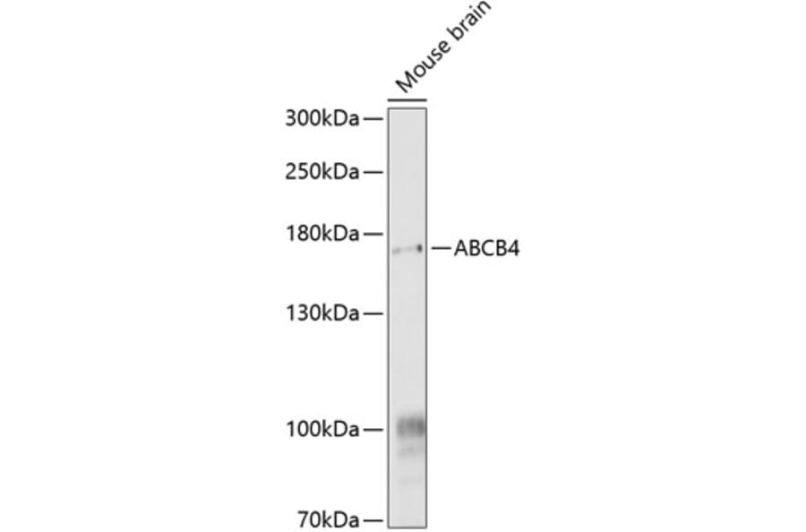 Western Blot - Anti-ABCB4 Antibody (A17122) - Antibodies.com