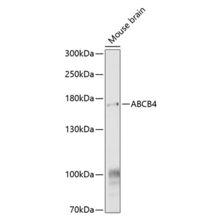 Western Blot - Anti-ABCB4 Antibody (A17122) - Antibodies.com