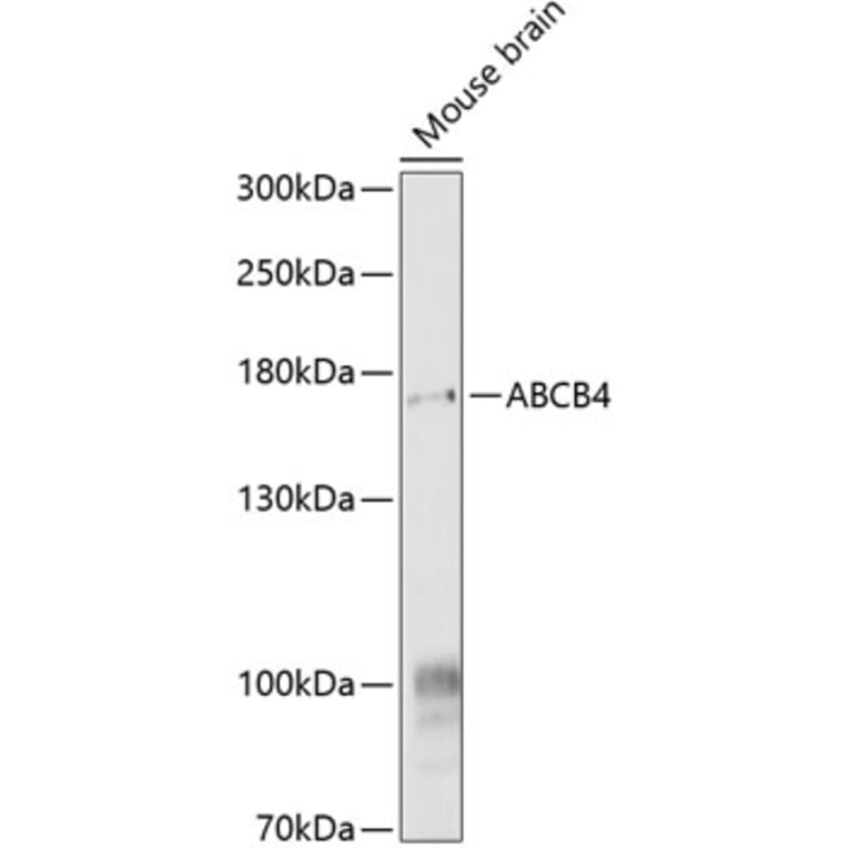 Western Blot - Anti-ABCB4 Antibody (A17122) - Antibodies.com