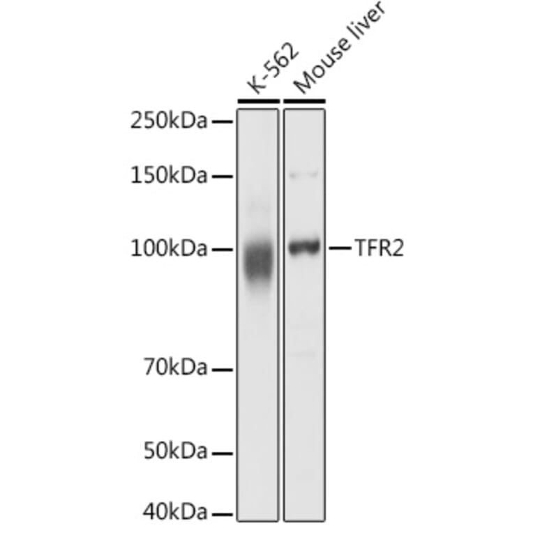 Western Blot - Anti-Transferrin Receptor 2/TFR2 Antibody (A17123) - Antibodies.com