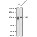 Western Blot - Anti-Transferrin Receptor 2/TFR2 Antibody (A17123) - Antibodies.com