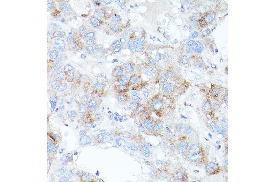 Immunohistochemistry - Anti-Transferrin Receptor 2/TFR2 Antibody (A17123) - Antibodies.com
