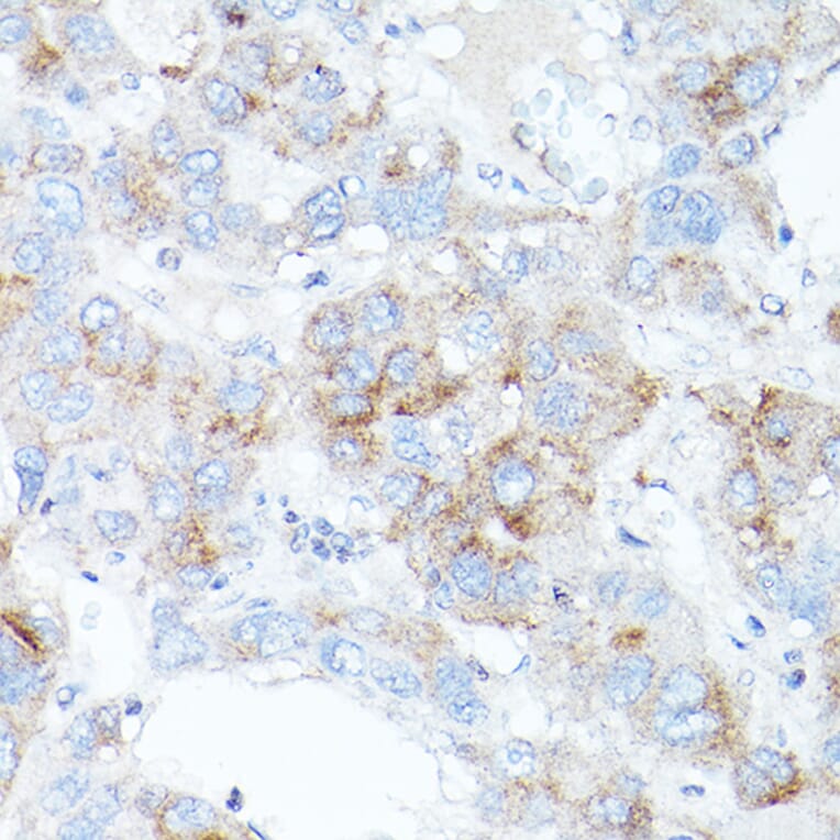 Immunohistochemistry - Anti-Transferrin Receptor 2/TFR2 Antibody (A17123) - Antibodies.com