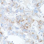 Immunohistochemistry - Anti-Transferrin Receptor 2/TFR2 Antibody (A17123) - Antibodies.com
