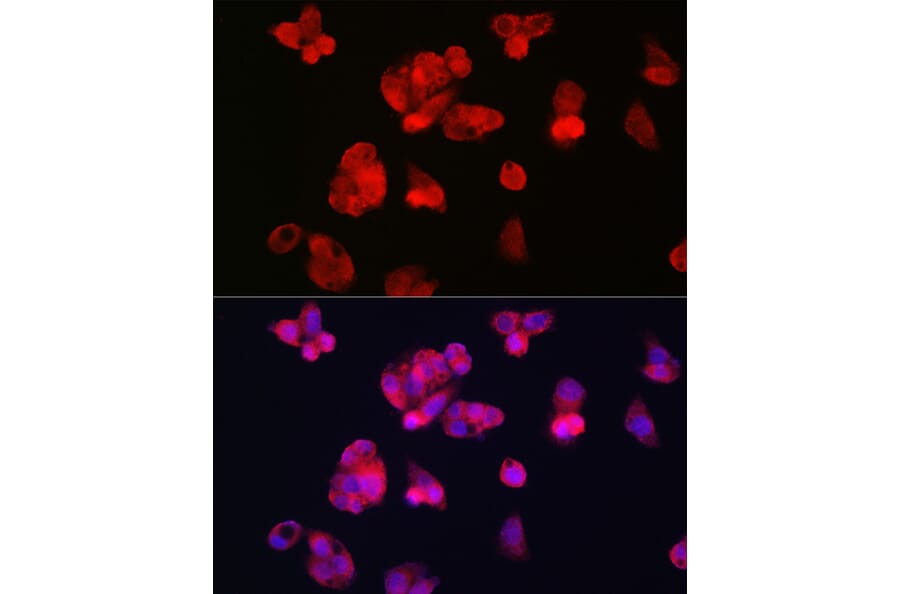 Immunofluorescence - Anti-Transferrin Receptor 2/TFR2 Antibody (A17123) - Antibodies.com
