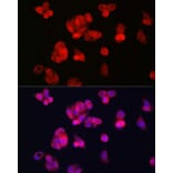 Immunofluorescence - Anti-Transferrin Receptor 2/TFR2 Antibody (A17123) - Antibodies.com
