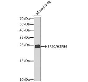 Western Blot - Anti-Hsp20 Antibody (A17124) - Antibodies.com