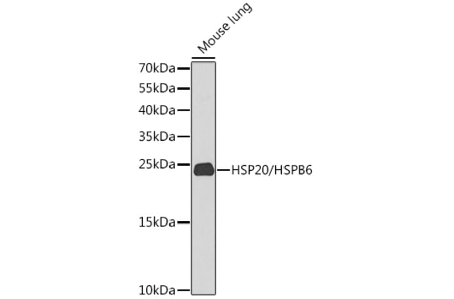 Western Blot - Anti-Hsp20 Antibody (A17124) - Antibodies.com