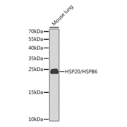 Western Blot - Anti-Hsp20 Antibody (A17124) - Antibodies.com