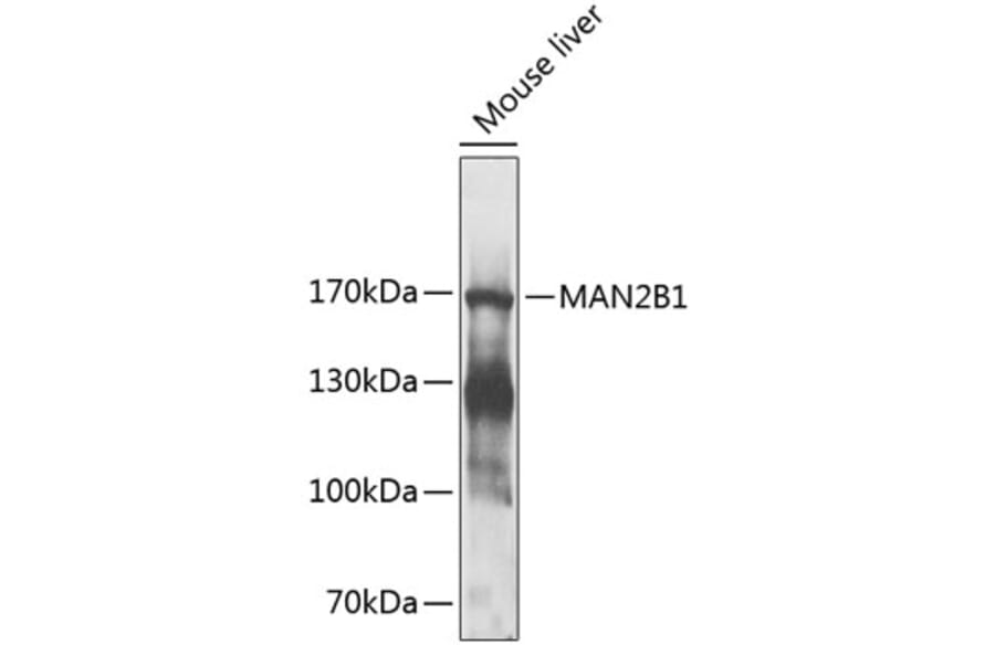 Western Blot - Anti-MAN2B1 Antibody (A17127) - Antibodies.com