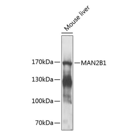 Western Blot - Anti-MAN2B1 Antibody (A17127) - Antibodies.com