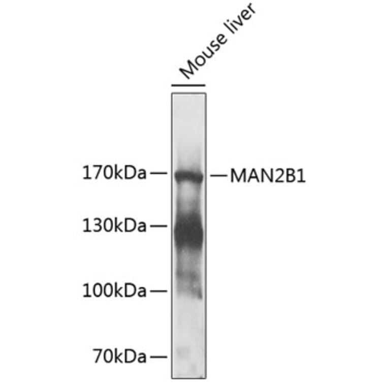 Western Blot - Anti-MAN2B1 Antibody (A17127) - Antibodies.com