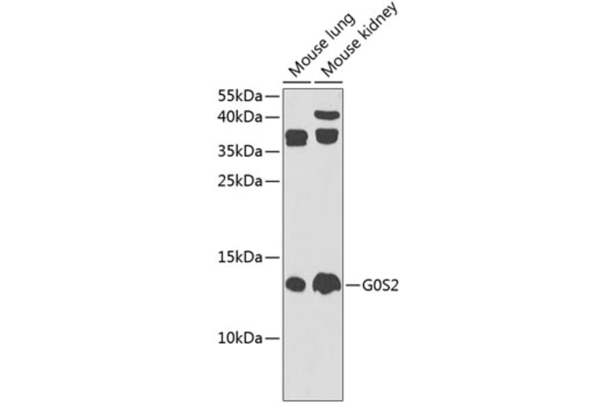Western Blot - Anti-G0/G1switch 2/G0S2 Antibody (A17128) - Antibodies.com