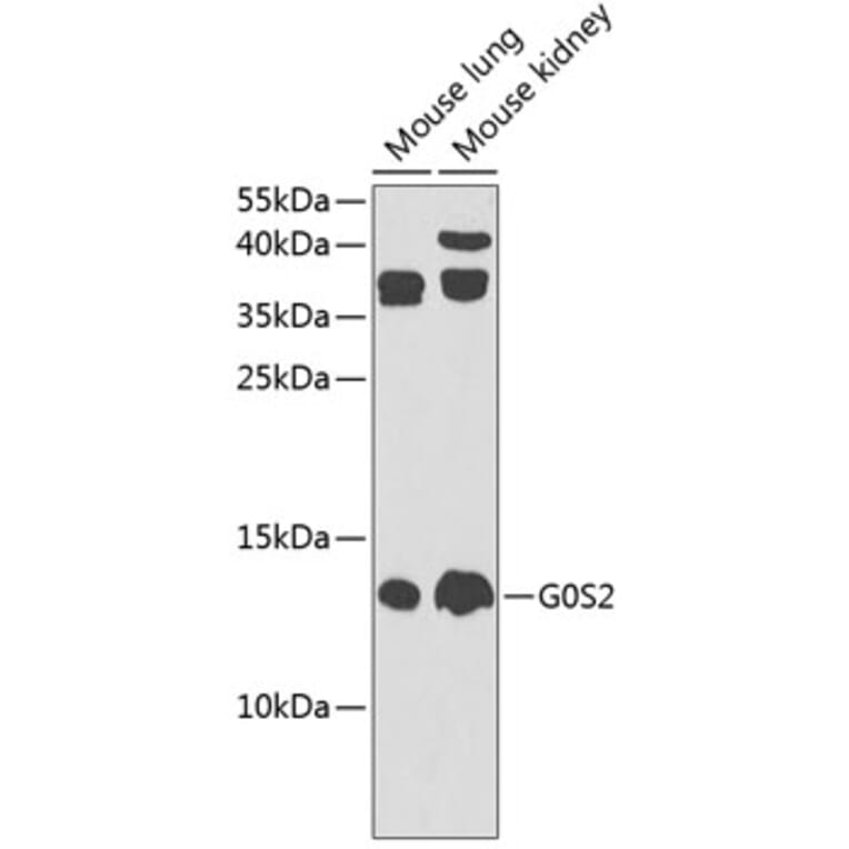 Western Blot - Anti-G0/G1switch 2/G0S2 Antibody (A17128) - Antibodies.com
