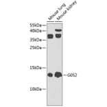 Western Blot - Anti-G0/G1switch 2/G0S2 Antibody (A17128) - Antibodies.com